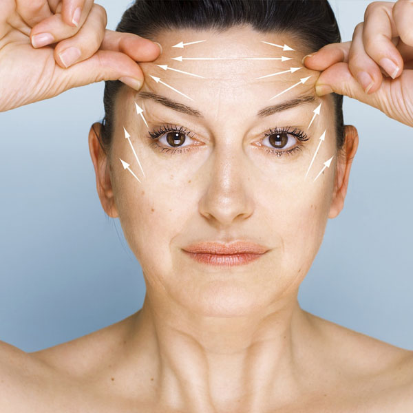 Brow lift