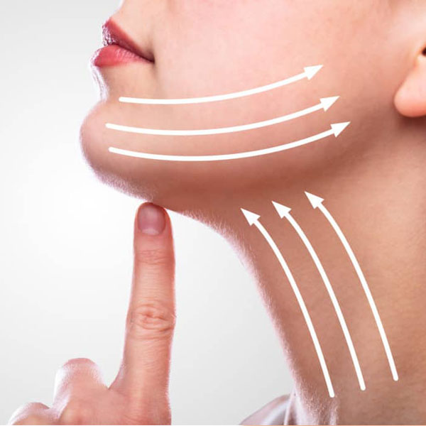 Neck Lift
