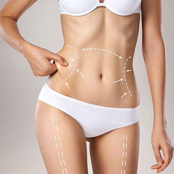 Vaser Liposculpture