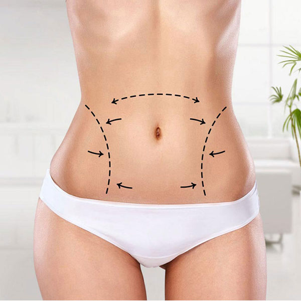 Liposuction